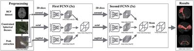 Automatic segmentation of the core of the acoustic radiation in humans